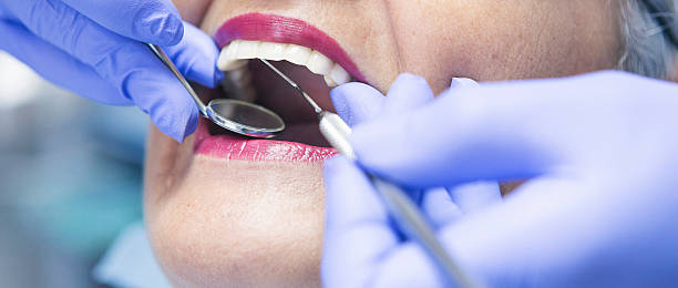 Best Emergency Dental Care for Broken or Chipped Teeth in Frederick, CO